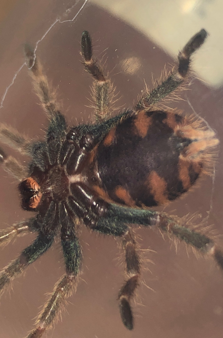 GBB male or Female