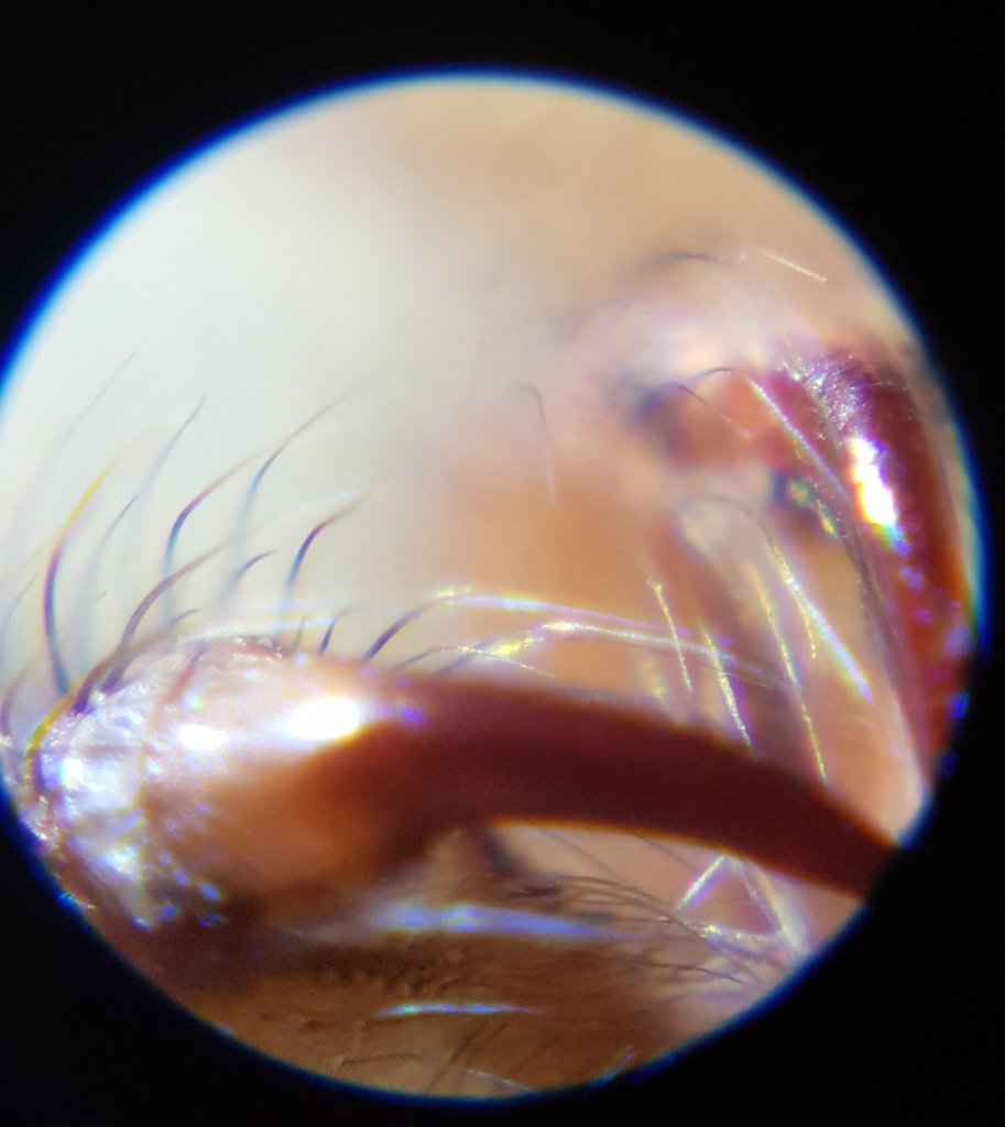 Tiny fangs with x120 magnification