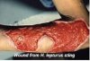 wound.JPG