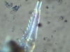 Symphypleona_sp._furca.png