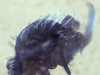 Symphypleona_sp._abdomenside.png