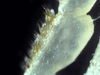 Nesodillo_sp._PhipunTiger_Leg1_meruscarpus.png