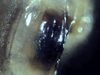 Nesodillo_sp._PhipunTiger_Mouth1.png