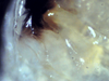 Nesodillo_sp._PhipunTiger_Mouth2.png