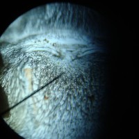 Balfouri Sex?