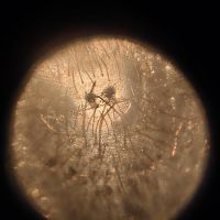 Pterinopelma Sazimai, 1.25 inch DLS 150x microscope zoom