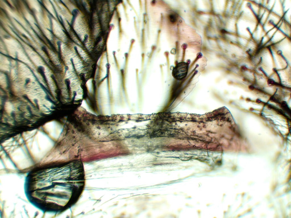 1" B. boehemi molt under microscope