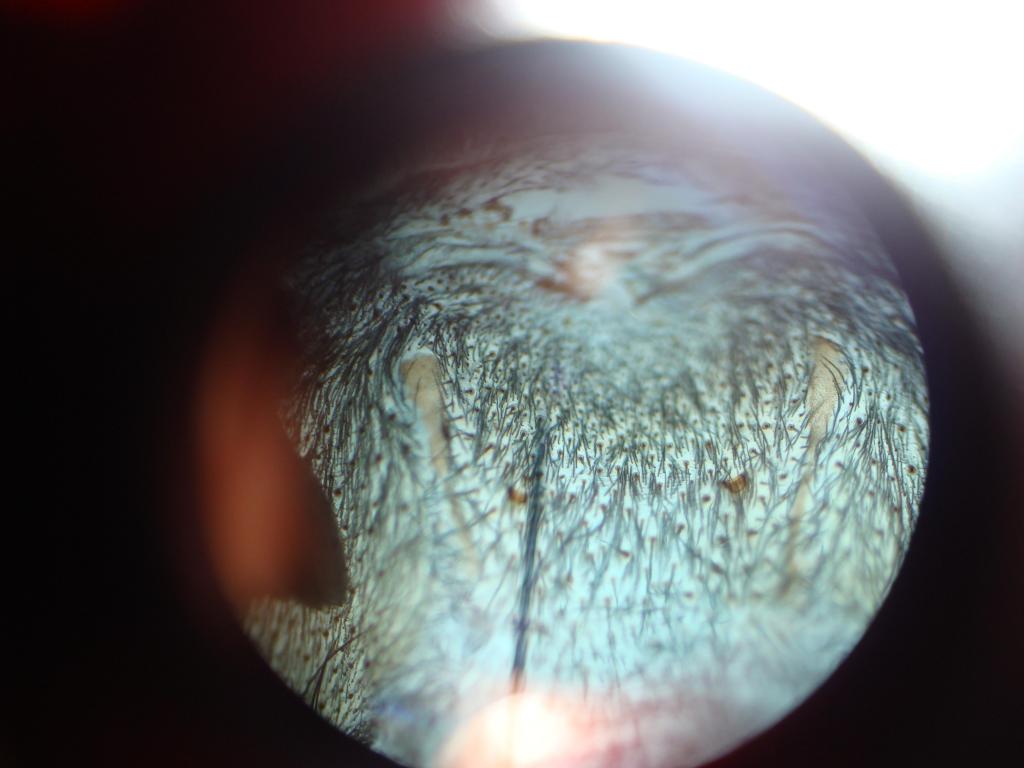 Balfouri Sex?