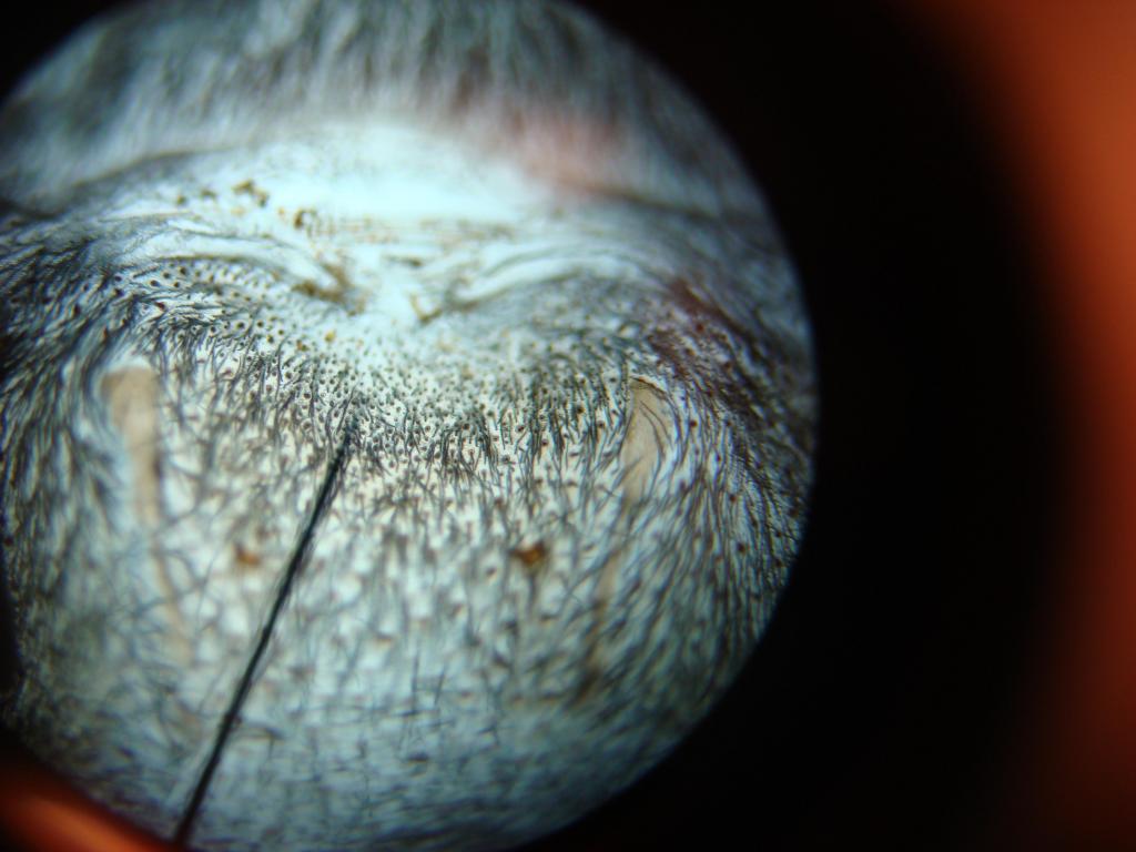 Balfouri Sex?