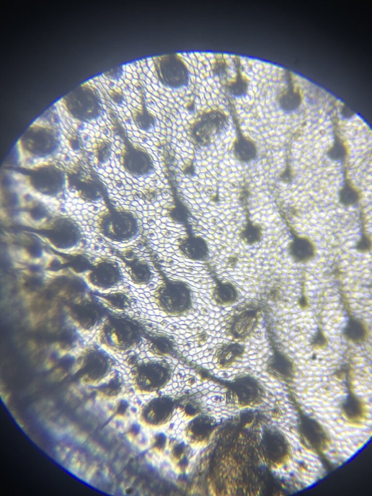 Linothele megatheloides setae under a microscope