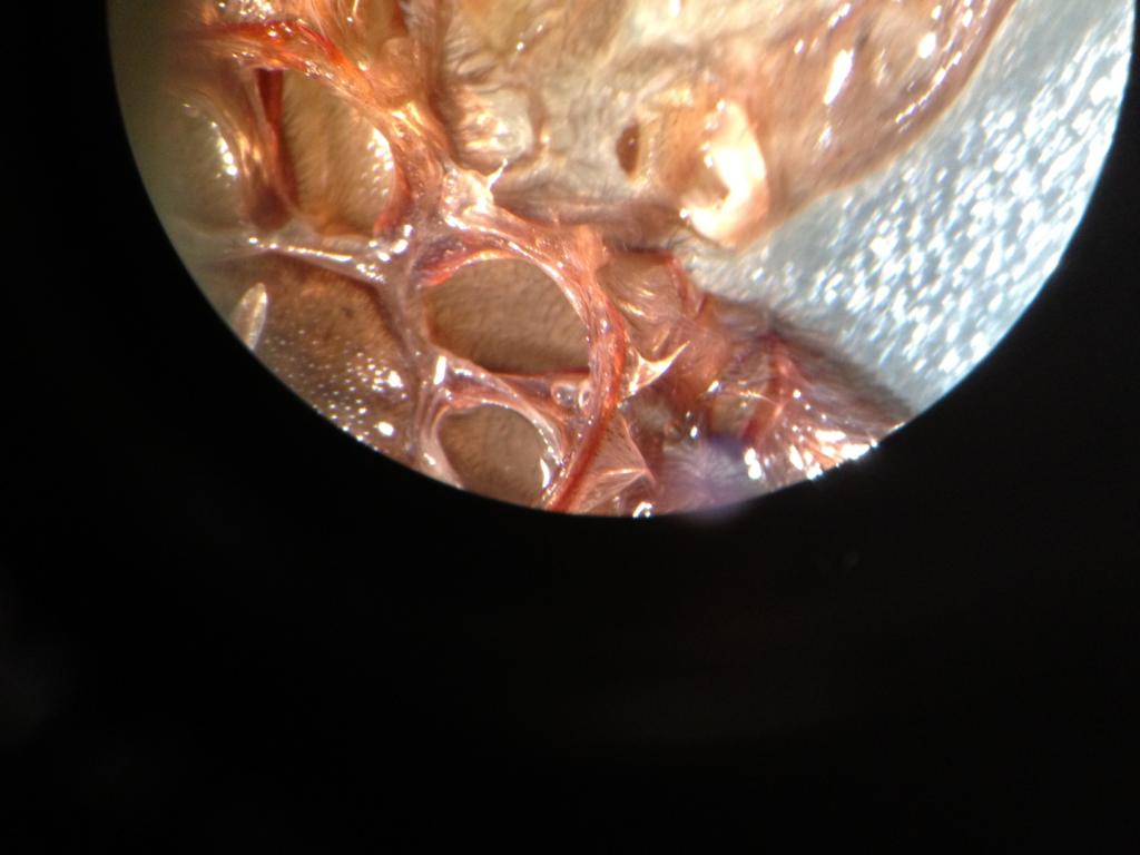 LP exuvia 2