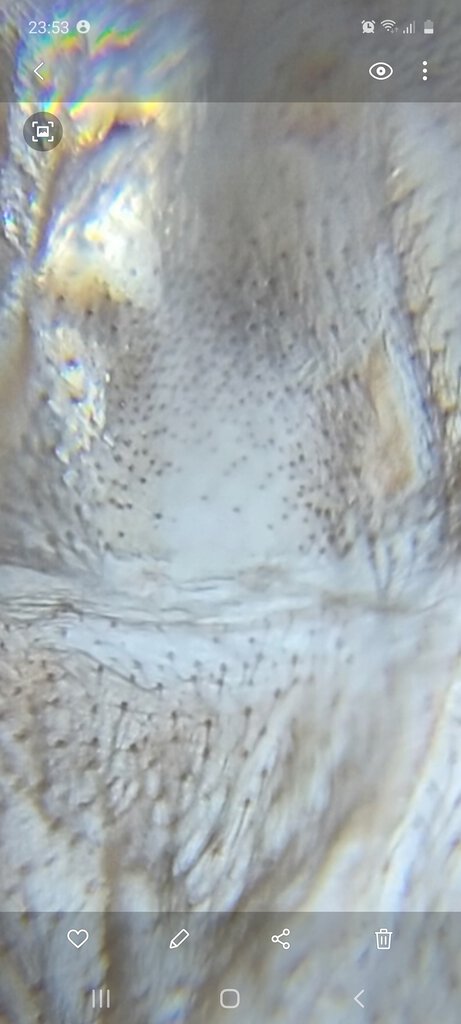 P. Metallica sex?
