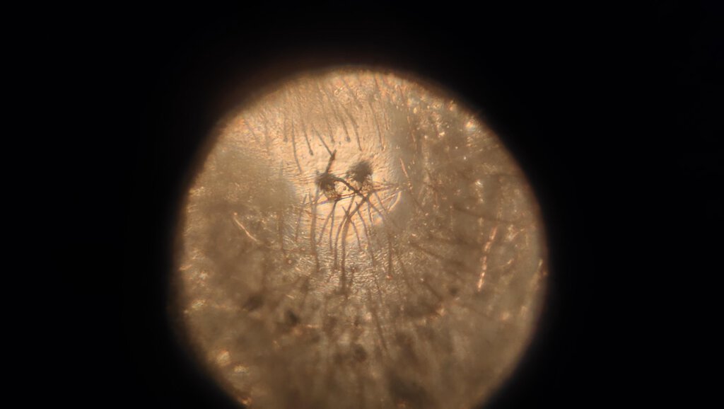 Pterinopelma Sazimai, 1.25 inch DLS 150x microscope zoom